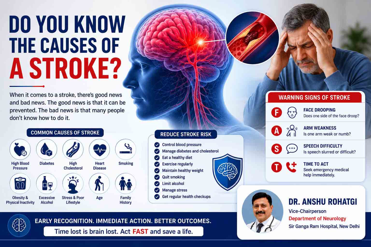 Do You Know the Causes of a Stroke? 